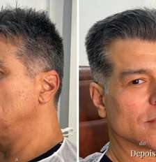 Maurício Mattar, antes e depois Foto: Reprodução | Instagram