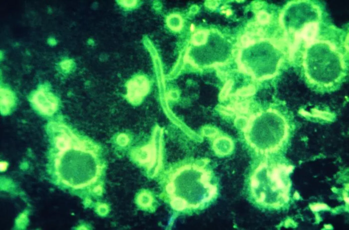 Fotomicrografia de uma amostra humana obtida de um paciente com peste, revelando numerosas bactérias em forma de bastonete, Yersinia pestis.